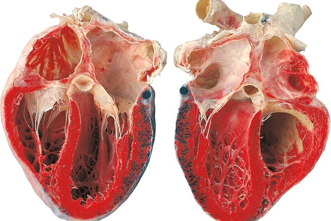 Ticket Expo Body Worlds in Bruges, Belgium - Who will enjoy Body Worlds Vital most?